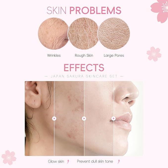 LAIKOU Sakura Skincare Set for Teen Girls, Complete 34PCS Face Care Kit